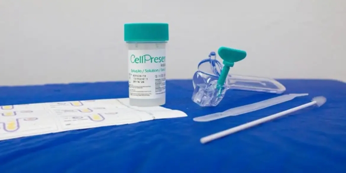 Foto de capa da notícia