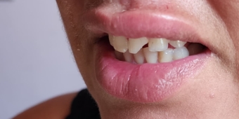 Imagem de capa da notícia