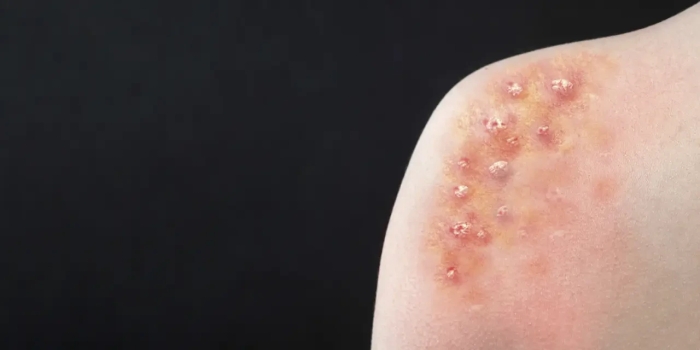 Foto de capa da notícia