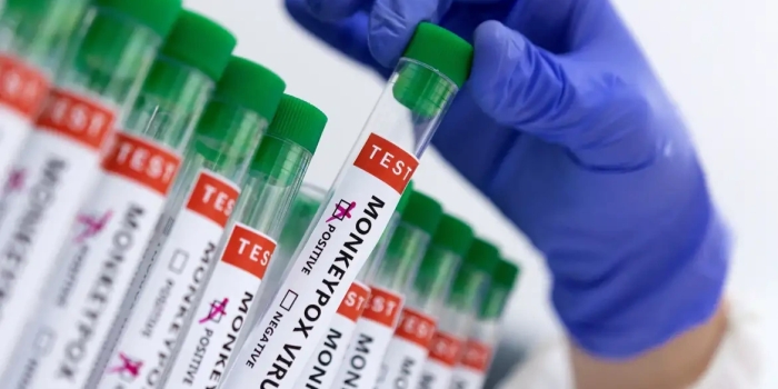 Foto de capa da notícia