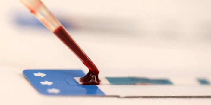 Foto de capa da notícia