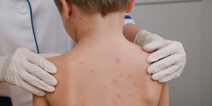 Foto de capa da notícia