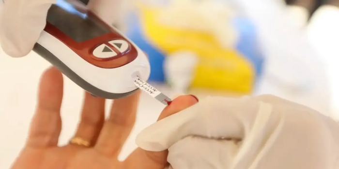 Foto de capa da notícia